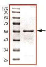 SDS-PAGE - Recombinant Human PHLPP2 protein (AB125556)