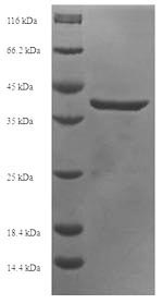 SDS-PAGE - Recombinant Human PHO1 protein (Tagged) (AB235615)