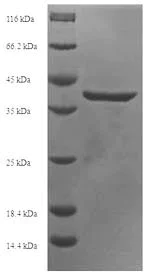 SDS-PAGE - Recombinant Human PHO1 protein (Tagged) (AB235615)
