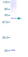 SDS-PAGE - Recombinant Human Phosphatidic acid phosphatase type 2B protein (GST tag N-Terminus) (AB160113)