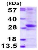 SDS-PAGE - Recombinant Human PHOSPHO2 protein (AB116206), expandable thumbnail