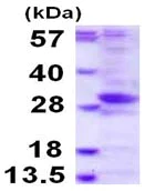 SDS-PAGE - Recombinant Human PHOSPHO2 protein (AB116206)