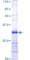 Recombinant Human Phospholipase C gamma 1/PLC-gamma-1 protein