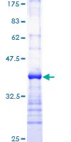 SDS-PAGE - Recombinant Human Phospholipase C gamma 1/PLC-gamma-1 protein (GST tag N-Terminus) (AB112339)