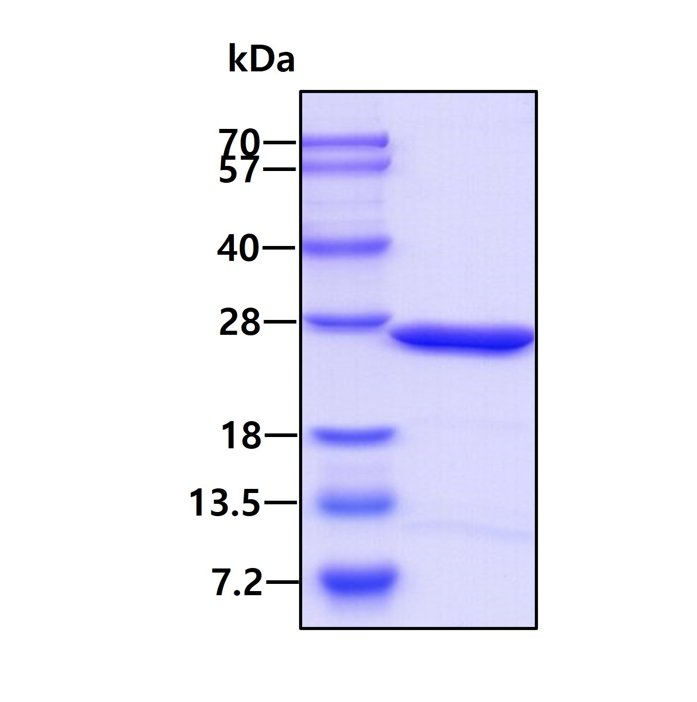 SDS-PAGE - Recombinant Human Phosphomevalonate kinase protein (His tag N-Terminus) (AB101170)