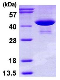 SDS-PAGE - Recombinant Human Phosphoserine Aminotransferase protein (His tag N-Terminus) (AB116152)