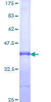 SDS-PAGE - Recombinant Human PI 3 Kinase p110 delta protein (GST tag N-Terminus) (AB159129)