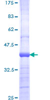SDS-PAGE - Recombinant Human PI3 Kinase p110 beta protein (AB159128), expandable thumbnail