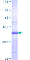 SDS-PAGE - Recombinant Human PI3 Kinase p110 beta protein (GST tag N-Terminus) (AB159128)
