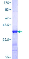 SDS-PAGE - Recombinant Human PIBF protein (AB161008)