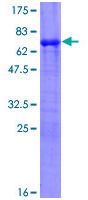 SDS-PAGE - Recombinant Human Piccolo protein (AB132154)