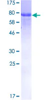 SDS-PAGE - Recombinant Human PICH protein (GST tag N-Terminus) (AB162850)