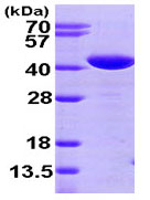 SDS-PAGE - Recombinant Human PICOT protein (His tag N-Terminus) (AB95263)