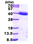 SDS-PAGE - Recombinant Human PIG3 protein (AB95857), expandable thumbnail