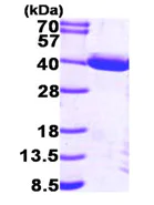 SDS-PAGE - Recombinant Human PIG3 protein (His tag N-Terminus) (AB95857)
