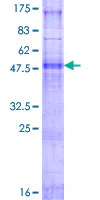 SDS-PAGE - Recombinant Human PIGC protein (GST tag N-Terminus) (AB159120)