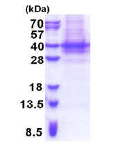 SDS-PAGE - Recombinant Human PIH1D1 protein (denatured) (His tag N-Terminus) (AB176047)
