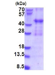 Recombinant Human PIH1D2 protein