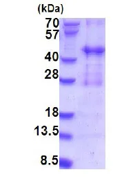 SDS-PAGE - Recombinant Human PIH1D2 protein (AB187487)