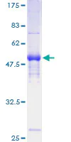 SDS-PAGE - Recombinant Human PILRA protein (AB162304)