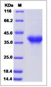 SDS-PAGE - Recombinant Human PILRA protein (His tag) (AB276589)