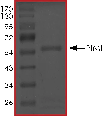 SDS-PAGE - Recombinant human PIM1 protein (AB60835)