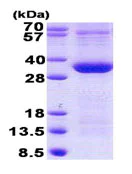 SDS-PAGE - Recombinant Human PIM1 protein (His tag N-Terminus) (AB140588)