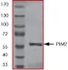 SDS-PAGE - Recombinant human PIM2 protein (AB60836)