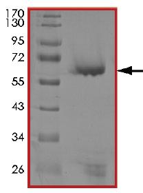 SDS-PAGE - Recombinant human PIM3 protein (AB204146), expandable thumbnail