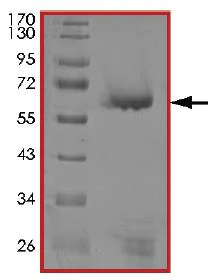 SDS-PAGE - Recombinant human PIM3 protein (AB204146)