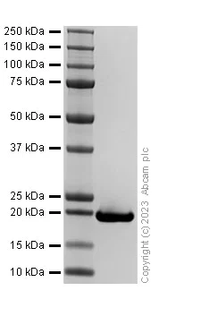 SDS-PAGE - Recombinant Human PIN1 Protein (His tag) (E.Coli) (AB313358)