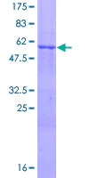 SDS-PAGE - Recombinant Human PINCH 1 protein (AB116807)