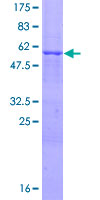 SDS-PAGE - Recombinant Human PINCH 1 protein (GST tag N-Terminus) (AB116807)