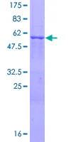 SDS-PAGE - Recombinant Human PINCH 1 protein (GST tag N-Terminus) (AB116807)