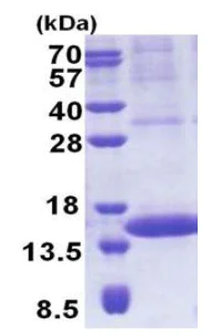 SDS-PAGE - Recombinant Human PIP protein (denatured) (His tag N-Terminus) (AB171678)