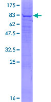 Recombinant Human PIP5K1 alpha/PIP5K1A protein