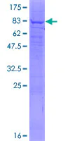 SDS-PAGE - Recombinant Human PIP5K1 alpha/PIP5K1A protein (GST tag N-Terminus) (AB160016)