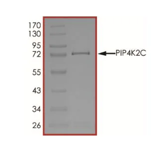 SDS-PAGE - Recombinant human PIP5K2 gamma protein (Active) (AB268870)