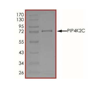 SDS-PAGE - Recombinant human PIP5K2 gamma protein (Active) (GST tag N-Terminus) (AB268870)