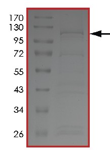 SDS-PAGE - Recombinant human PIP5K3/PIKFYVE protein (AB207977), expandable thumbnail