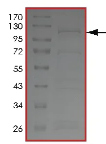 SDS-PAGE - Recombinant human PIP5K3/PIKFYVE protein (AB207977)