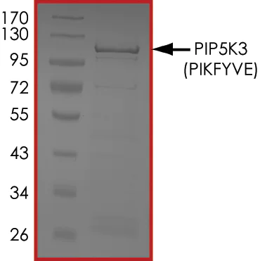 SDS-PAGE - Recombinant human PIP5K3/PIKFYVE protein (AB207977)
