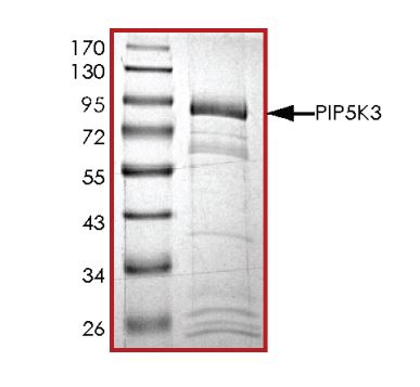 SDS-PAGE - Recombinant Human PIP5K3/PIKFYVE protein (Tagged) (AB268873), expandable thumbnail