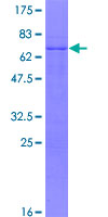 SDS-PAGE - Recombinant Human PITX1/BFT protein (AB114744), expandable thumbnail