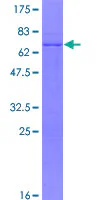 SDS-PAGE - Recombinant Human PITX1/BFT protein (GST tag N-Terminus) (AB114744)