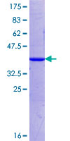 SDS-PAGE - Recombinant Human PIWIL1 protein (AB152968), expandable thumbnail