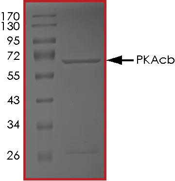 SDS-PAGE - Recombinant human PKA beta (catalytic subunit) protein (AB60837)