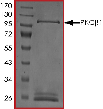 SDS-PAGE - Recombinant human PKC beta 1 protein (AB60840), expandable thumbnail