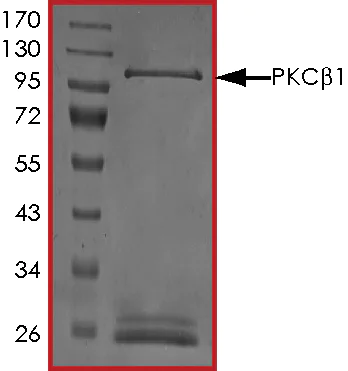 SDS-PAGE - Recombinant human PKC beta 1 protein (AB60840)