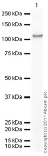 Western blot - Recombinant human PKC beta 1 protein (ab60840), expandable thumbnail